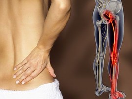 محفظة النقود وآلام الظهر عند الرجال